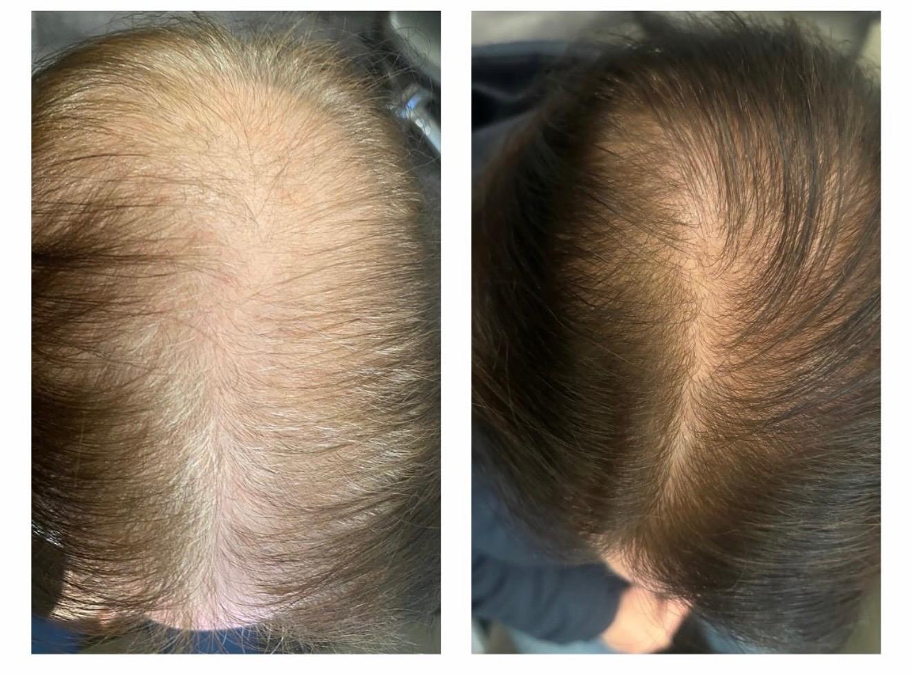 Trichologie – Bild 2