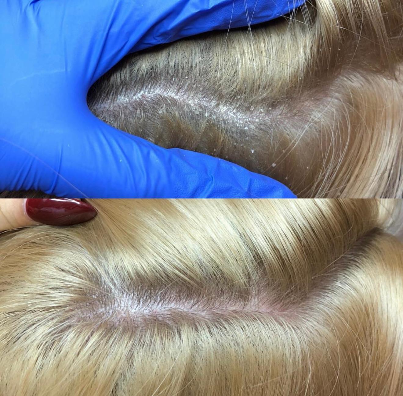 Trichologie – Bild 3